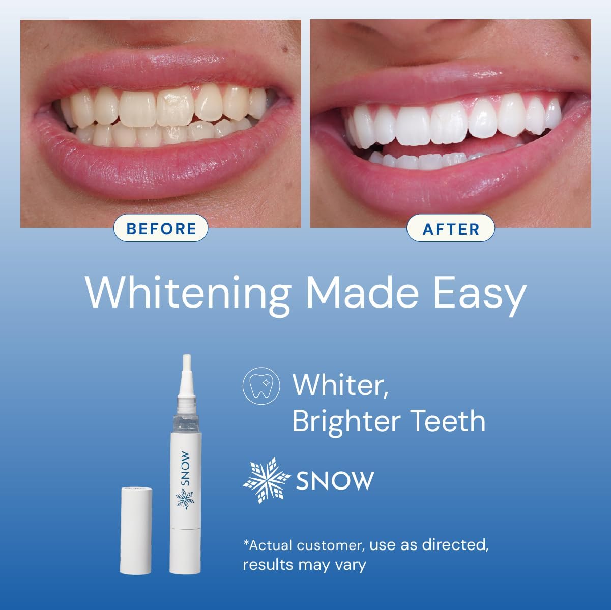 SNOW DiamondSeries 2ml Travel Size Wand for Teeth Strengthening and Enamel Repair - Image 4