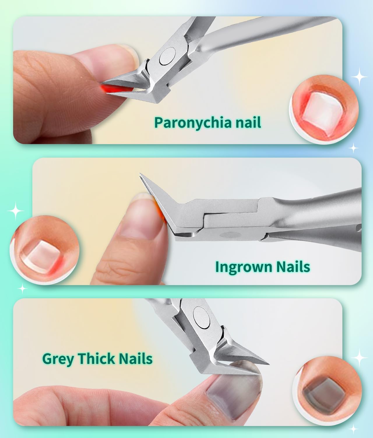 Heavy Duty Stainless Steel Ingrown Toenail Clippers for Thick Nails, Slanted Tip, Size Medium - Image 3