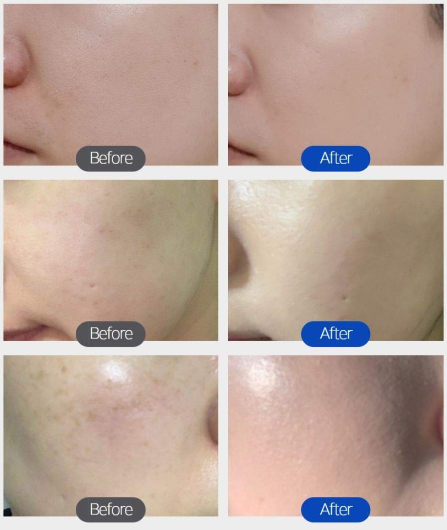 TROIAREUKE H+ Formula Aesthetic BB Cream SPF50+ PA+++ for Oily Skin 30ml - Image 3