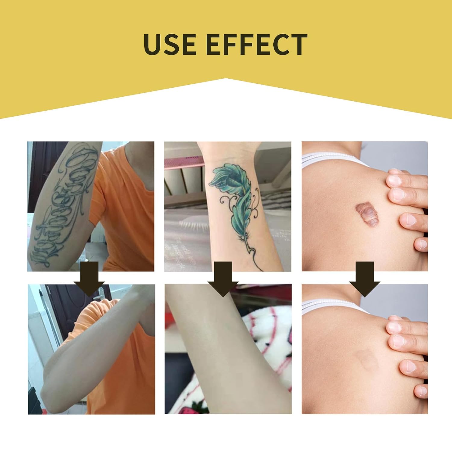 Ultra Thin Waterproof Tattoo Cover Up Tape - Breathable Skin Concealer Patch for Scars - Image 7