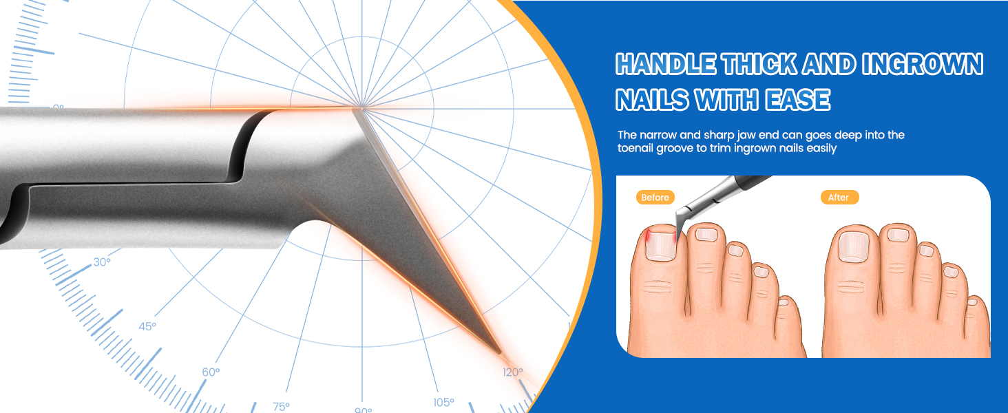 ingrown toenail kit ingrown toe nail remover  toenail scissors podiatrist toenail clippers