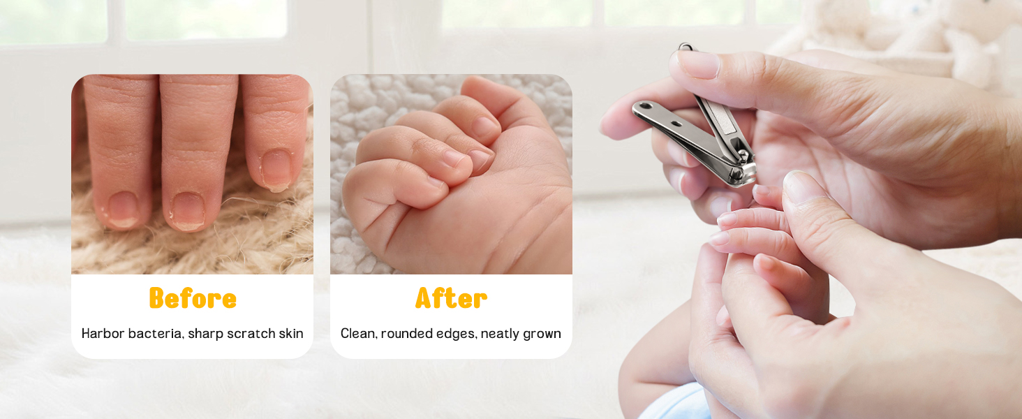 safe nail clipper