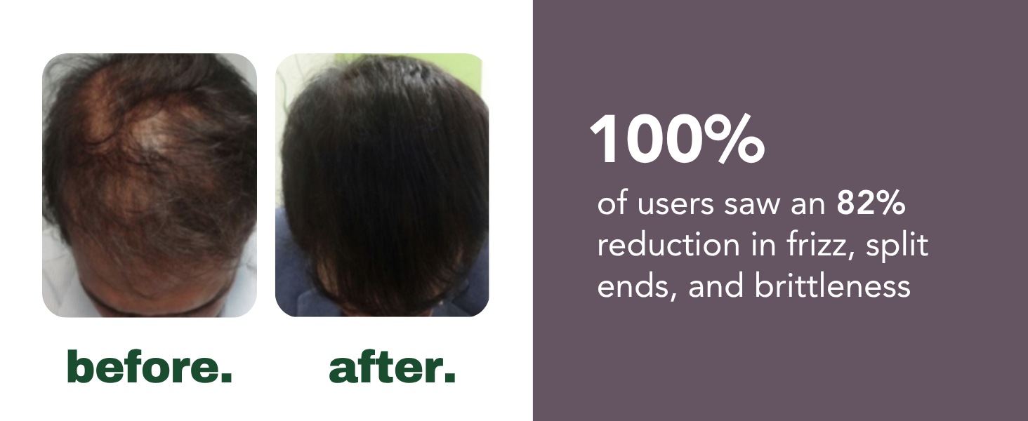 HairSmart Result 4
