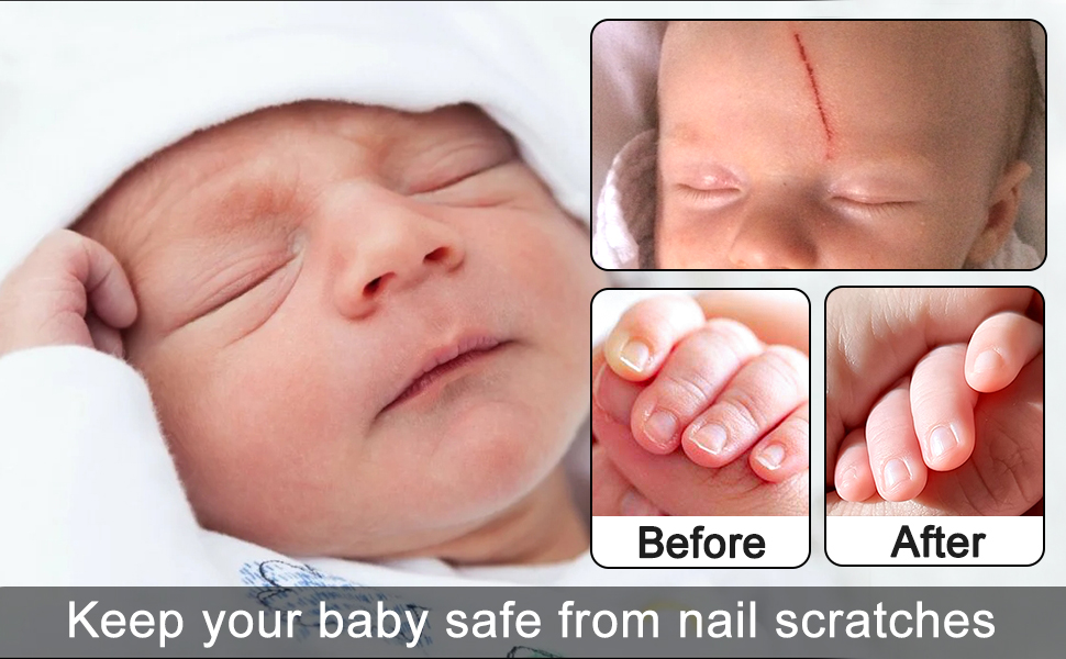 Baby Nail Trimmer Electric