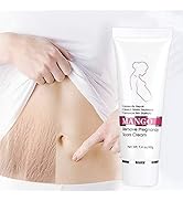 Stretch Mark Cream, Crema Para Las Estrias Crema Para Estrias De Embarazo Crema Para Eliminar Est...