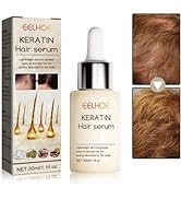 VOLLUCK Hair Growth Oil Hair Oil for Dry Damaged Hair and Growth Hair Thickening Products for Wom...