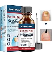 Nail Repair Essnce Liquid, Fingernail and Toenail Repair, Fix & Renew Damaged, Broken, Cracked & ...