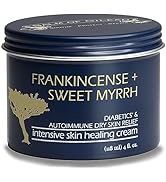 Frankincense + Sweet Myrrh Cream – INTENSIVE FOOT THERAPY | Diabetic Skin Healing Cream – Synergi...