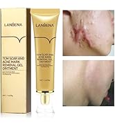 AKARY Acne Scar Removal Cream, Herbal Fade Scar Marks Burns Repair Cream, Stretch Marks Face Skin...