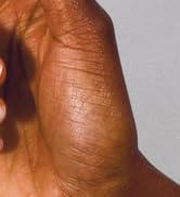 fingernail treatment oil damaged restore discolored discoloration appearance growth conditioning