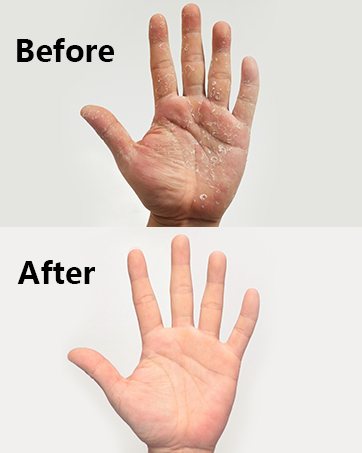 body cream