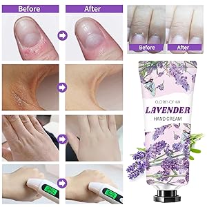 hand cream for dry hands