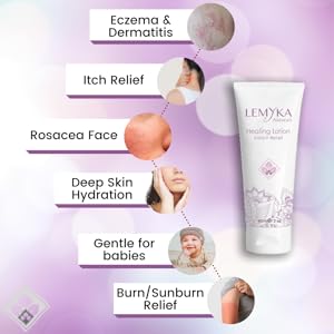 face dermatitis eczema rash lotion rosacea eyelid baby safe burn sunburn pregnant belly jock shingle