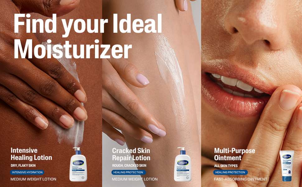 Cracked Skin Lotion