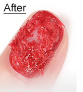 gel remover