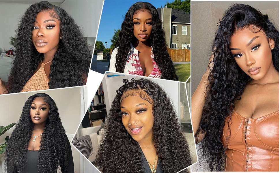 Natural Hairline