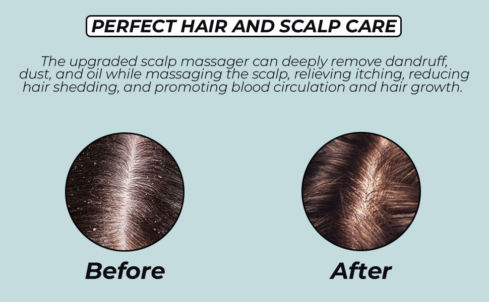 relax VIBES Scalp Massager Shampoo Brush with Soft Silicone Bristles for Scalp Care