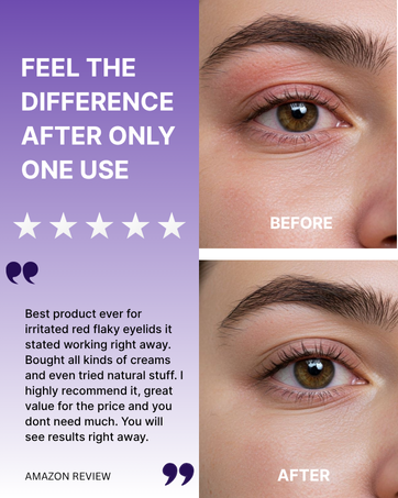 ointment review
