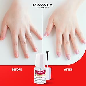 Before and after Mavala Stop