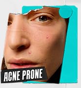 Kiehl's Truly Targeted Pimple Patch with 2% Salicylic Acid, Invisible Liquid Acne Spot Remover