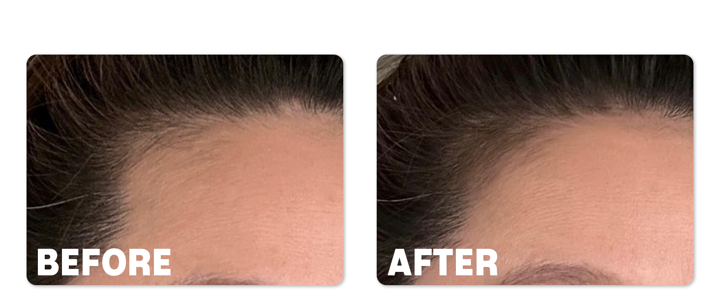 Hairline Powder for Women