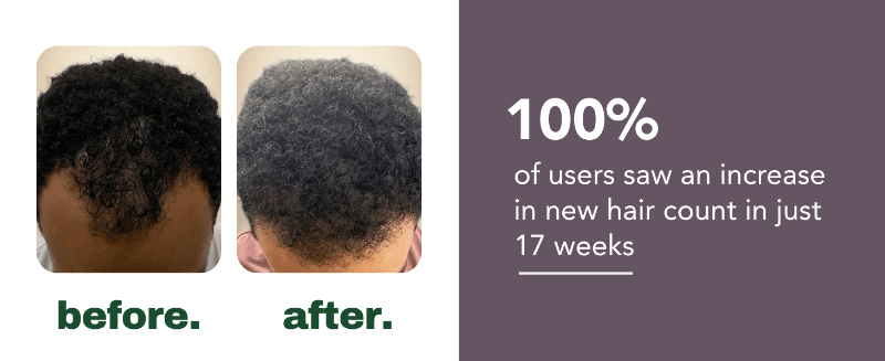 HairSmart Result 1