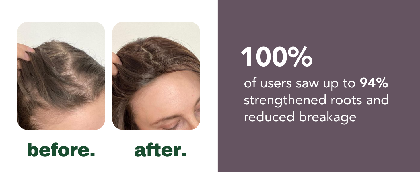 HairSmart Result 4