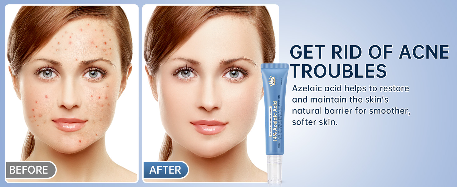 Azelaic Acid