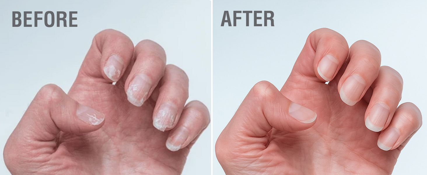 beauty care daby dabu non toxic hoof works before after nails hardenwer