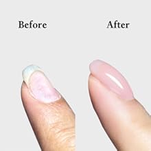 unevel nails 