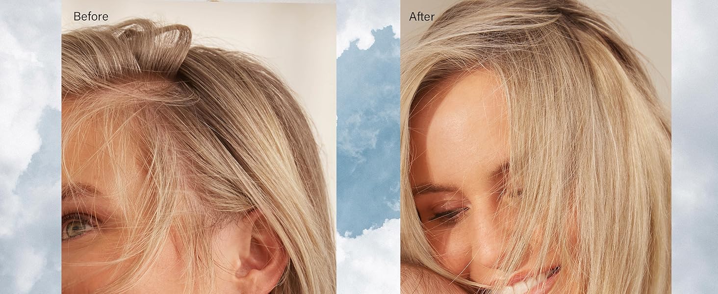 Luxy Hair Thinning Fill-Ins in beige blonde