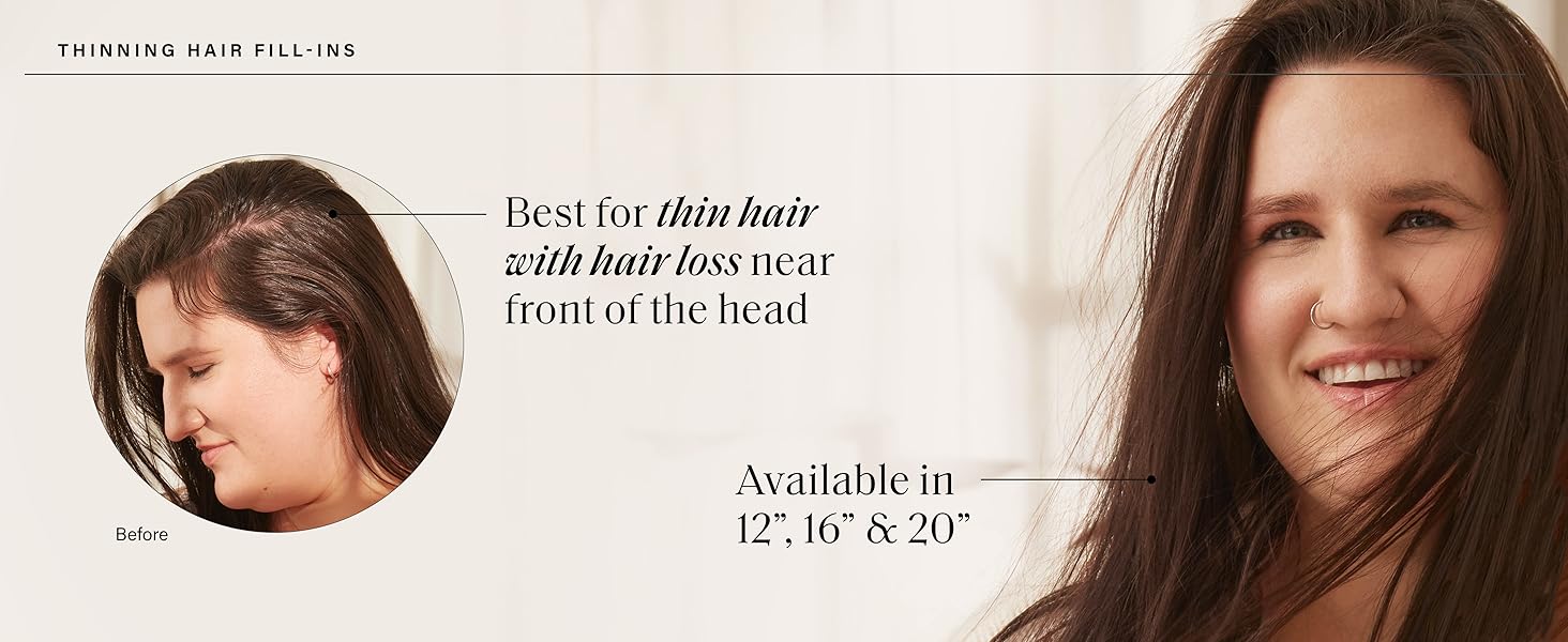 Thinning hair fill-ins. Don't let hair loss stand in your way.