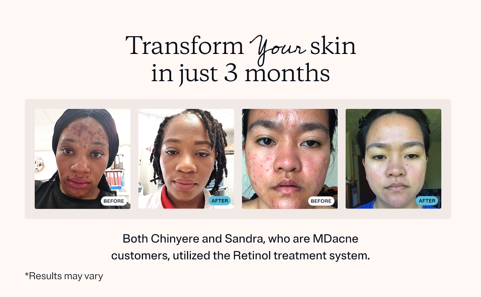 retinol cream, acne treatment kit, 3 step, adult acne, skin care, niacinamide, dry, oily skin