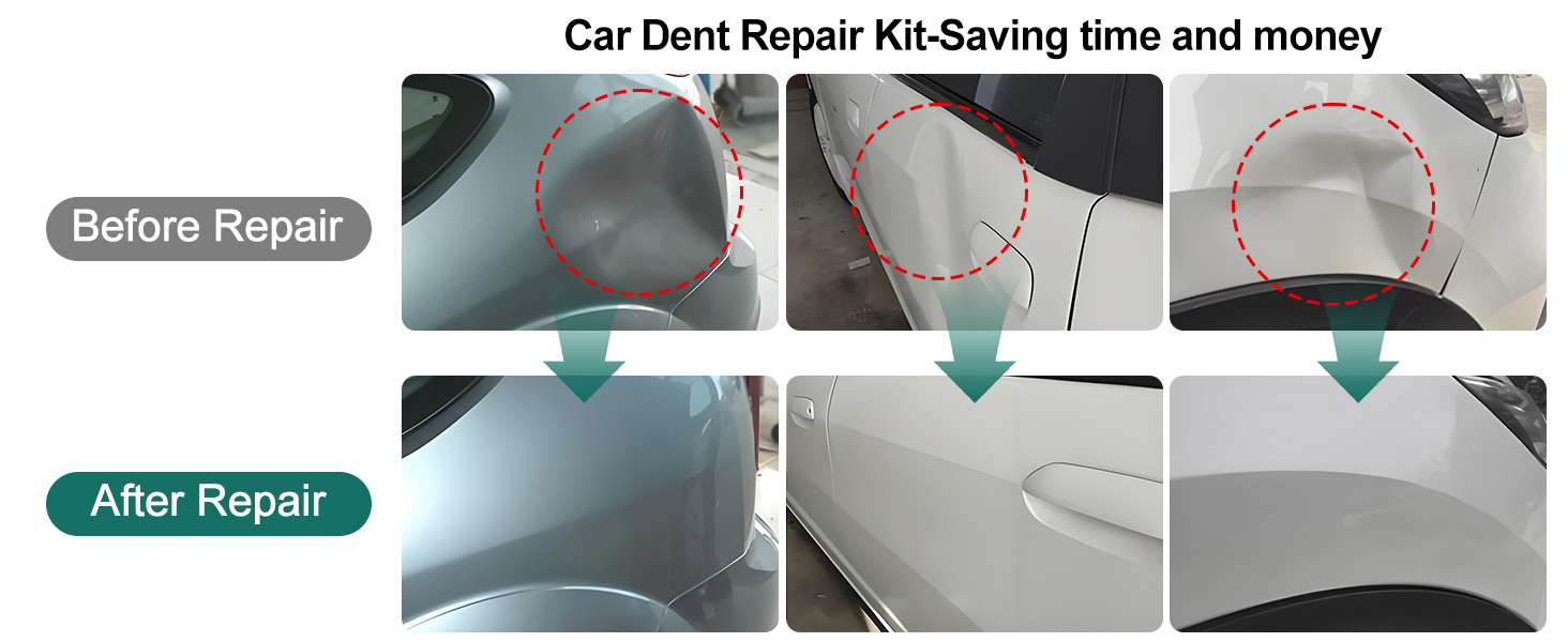 Dent Puller Hail Remover Kit, Car Paintless Dent Removal Kit Tools Dent Suction Puller Repair