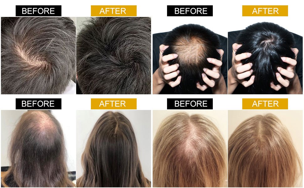 Venanoci Hair Growth Oil