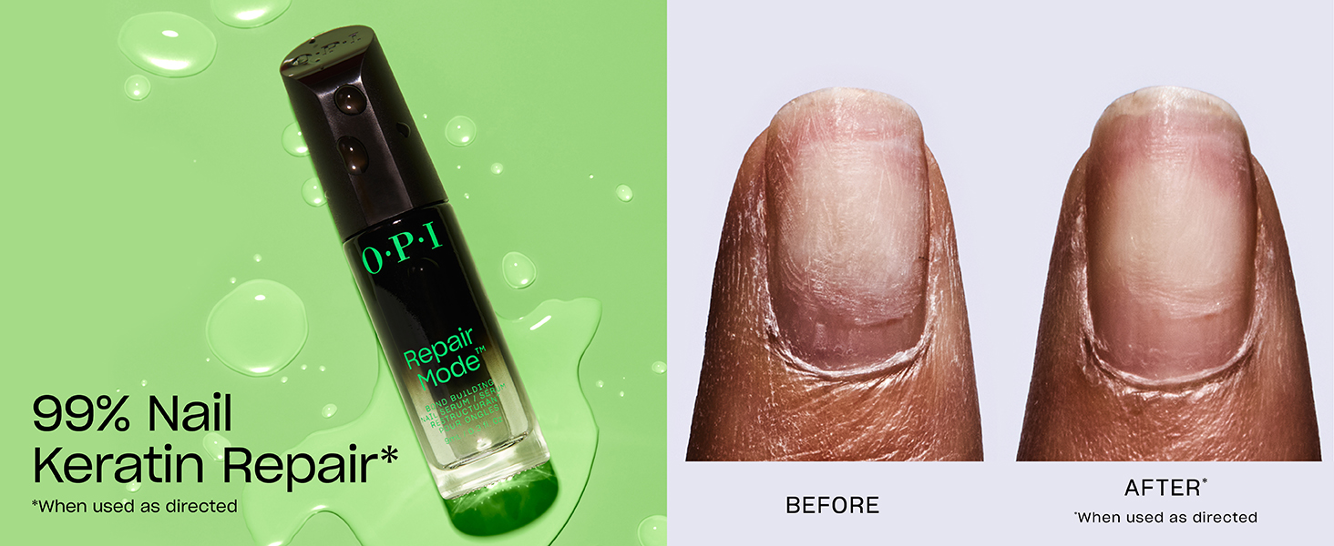 OPI