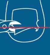 Toe Nail Clipper for Ingrown or Thick Toenails,Toenails Trimmer and Professional Podiatrist Toena...