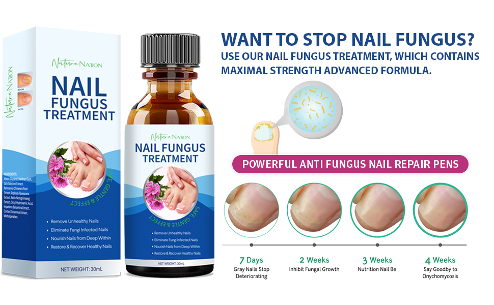 Toenail Fungus Treatment 2