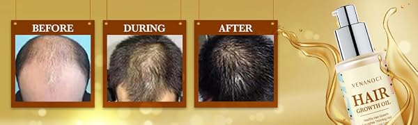 hair growth serum