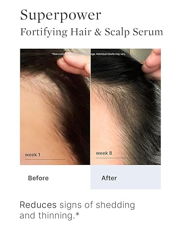 before and after