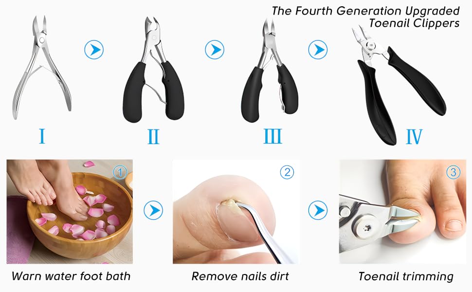 Ingrown Toenail Clippers