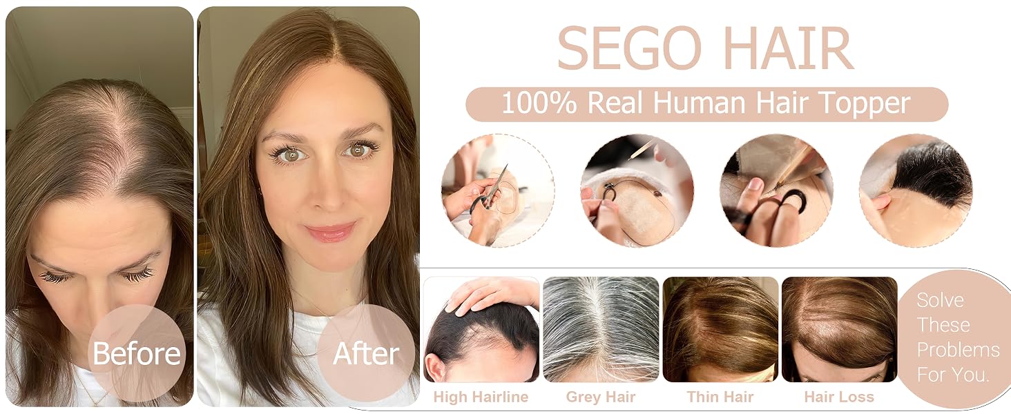 SEGO HAIR human hair toppers for women