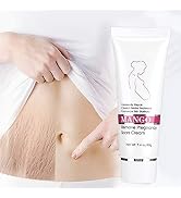 Stretch Mark Cream, Crema Para Las Estrias Crema Para Estrias De Embarazo Crema Para Eliminar Est...