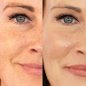face base before and after in fair skin
