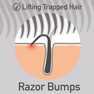 Dylonic Razor Bump Brush