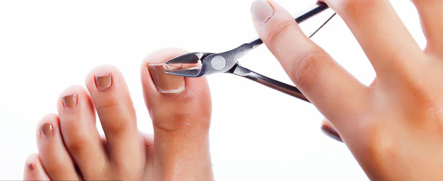toenail trim