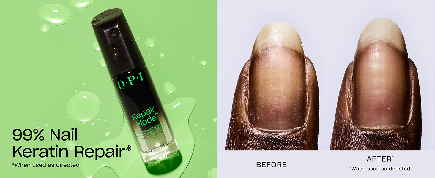 OPI