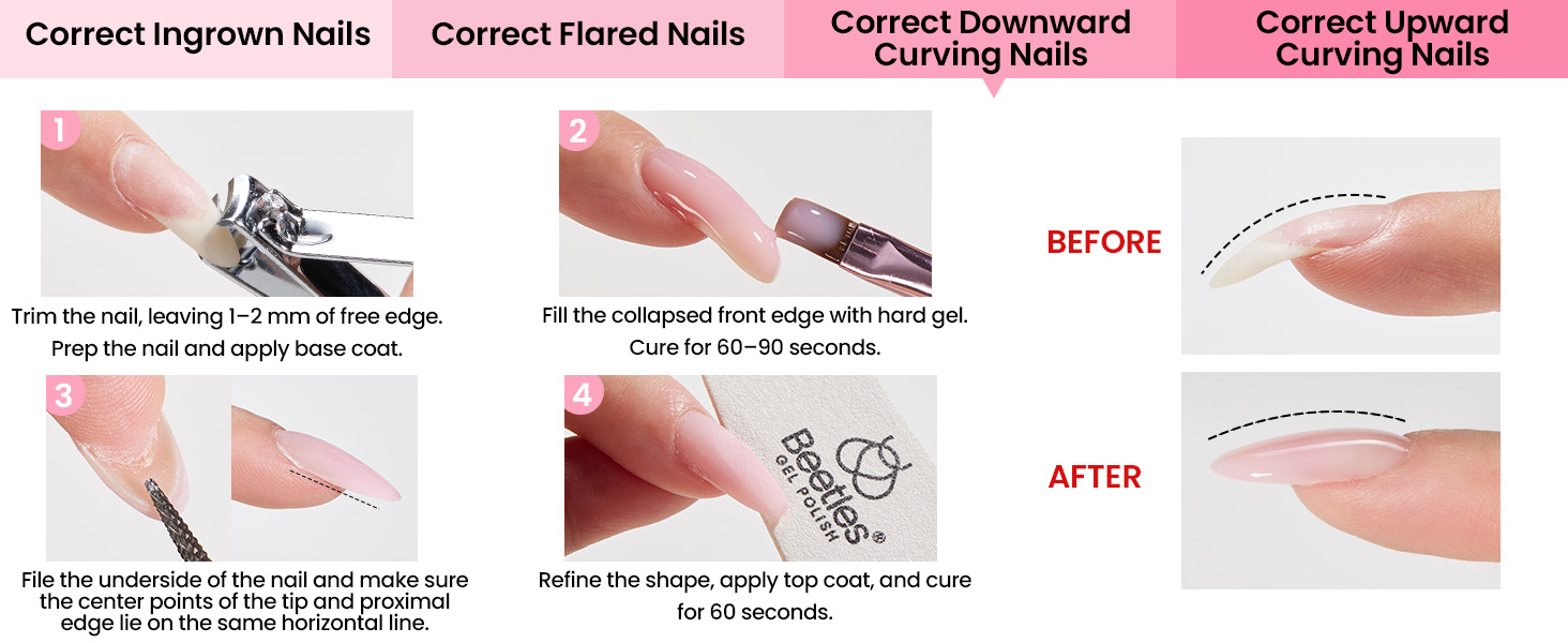 correct downard curving nails