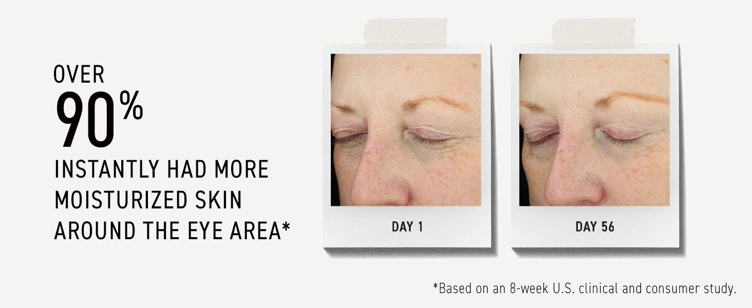 vitamin c, vitamin c serum, skin care, eye cream, skincare, cream, under eye brightener