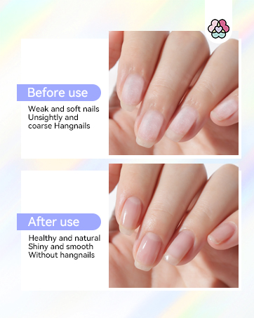Home Nail Care Kit